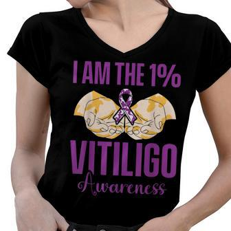 Vitiligo Awareness One Vitiligo Awareness Women V-Neck T-Shirt - Seseable
