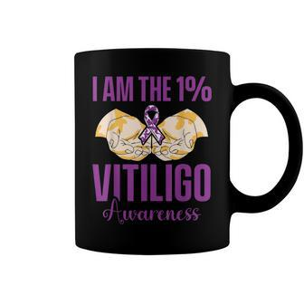 Vitiligo Awareness One Vitiligo Awareness Coffee Mug - Seseable