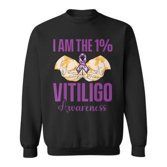 Vitiligo Awareness One Vitiligo Awareness Sweatshirt - Seseable