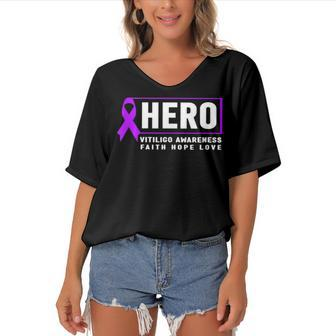 Vitiligo Awareness Hero - Purple Vitiligo Awareness Women's Bat Sleeves V-Neck Blouse - Seseable