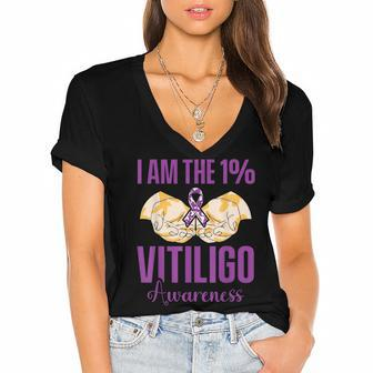 Vitiligo Awareness One Vitiligo Awareness Women's Jersey Short Sleeve Deep V-Neck Tshirt - Seseable