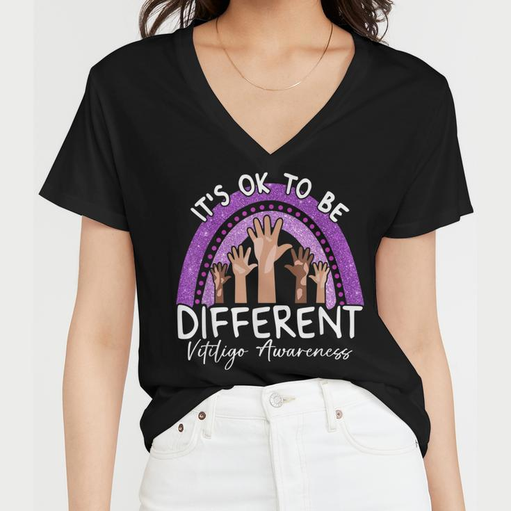 Its Ok To Be Different Vitiligo Awareness Women V-Neck T-Shirt