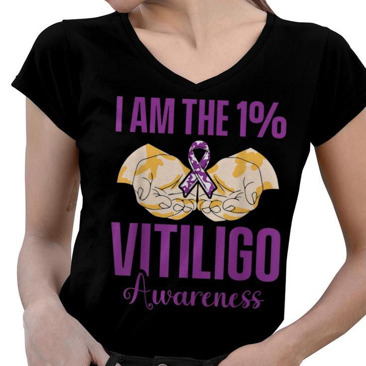 Vitiligo Awareness One Vitiligo Awareness  Women V-Neck T-Shirt