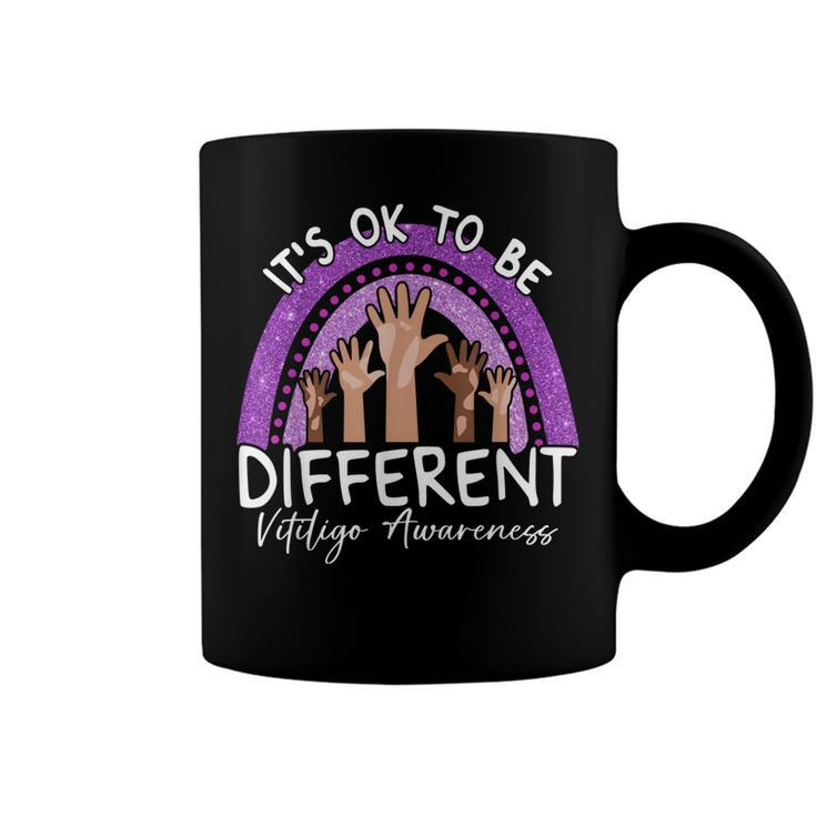 Its Ok To Be Different Vitiligo Awareness  Coffee Mug