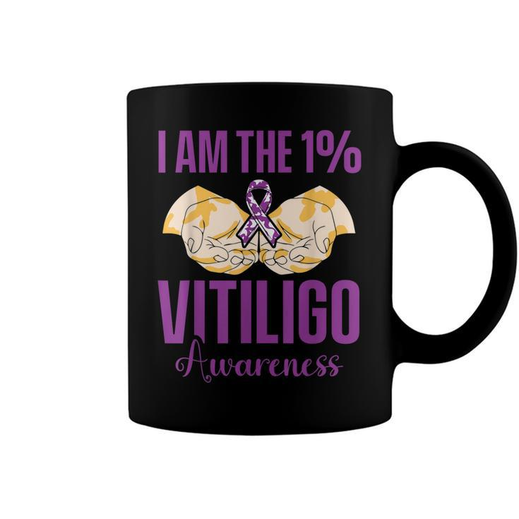 Vitiligo Awareness One Vitiligo Awareness  Coffee Mug