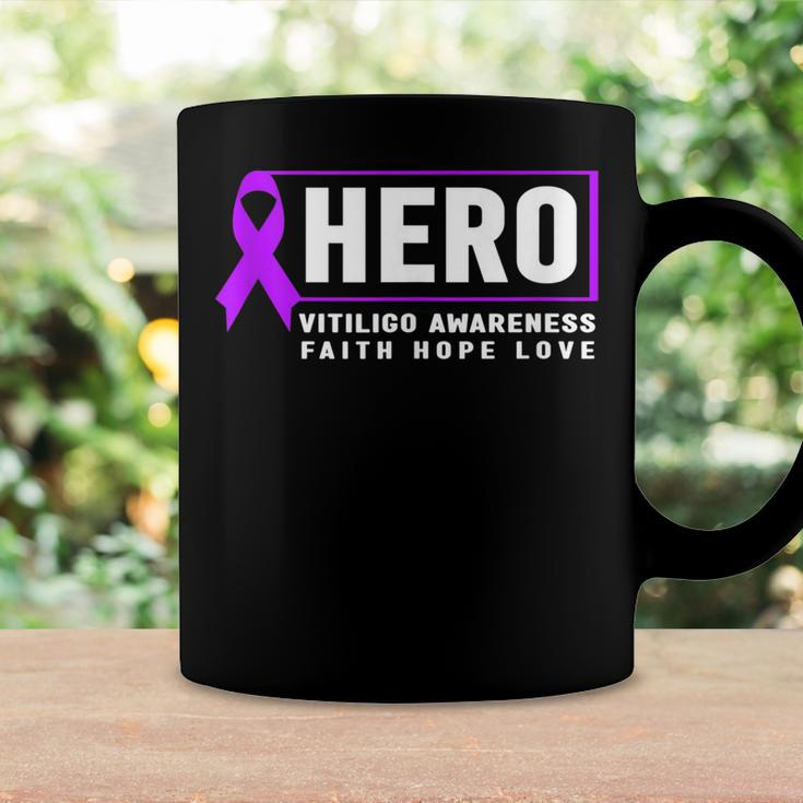 Vitiligo Awareness Hero - Purple Vitiligo Awareness Coffee Mug Gifts ideas