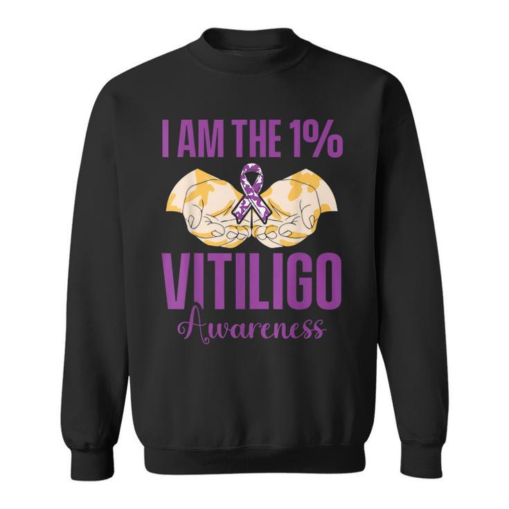 Vitiligo Awareness One Vitiligo Awareness  Sweatshirt