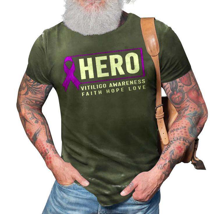 Vitiligo Awareness Hero  - Purple Vitiligo Awareness  3D Print Casual Tshirt