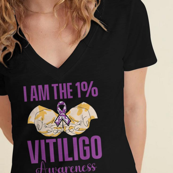 Vitiligo Awareness One Vitiligo Awareness Women's Jersey Short Sleeve Deep V-Neck Tshirt